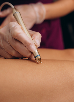Vascular Treatment